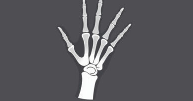 hand-oblique-x-ray.jpg