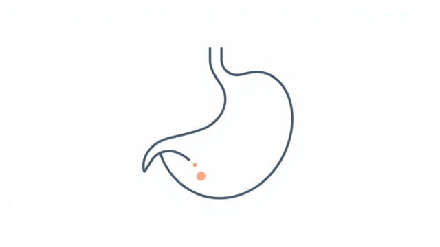 is-a-hiatal-hernia.jpg