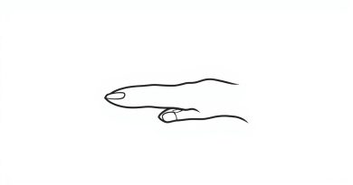 Bony Outgrowths On The Distal Interphalangeal Joints