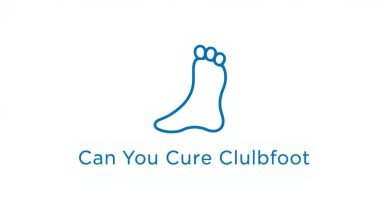 Can You Cure Clubfoot