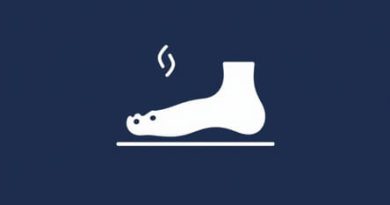 Clubfeet Is An Example Of Which Condition Listed? Quizlet