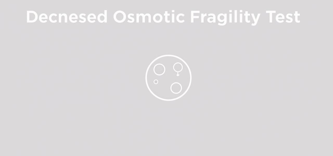 Decreased Osmotic Fragility Test