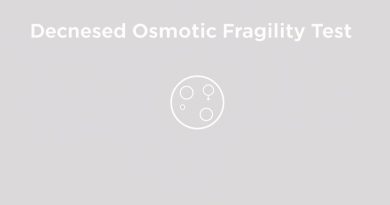 Decreased Osmotic Fragility Test