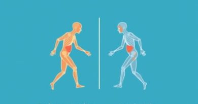 Difference Between Rheumatism And Arthritis Uk