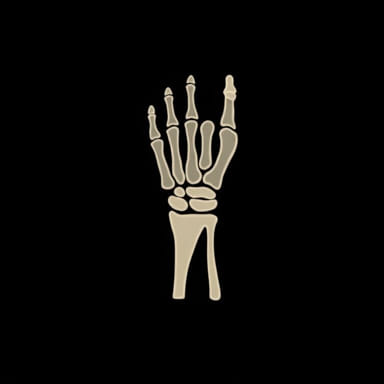 Displaced Distal Radius Fracture