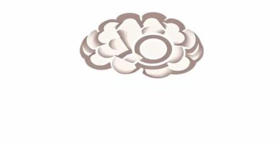 Can Ai Surpass Human Intelligence