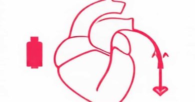 Cardiac Tamponade Jugular Vein Distention