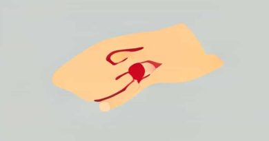 Does Massaging A Bruise Help