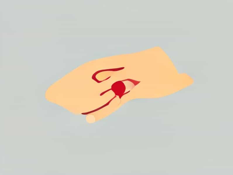 Does Massaging A Bruise Help