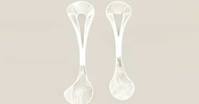 Fibrous Joints And Cartilaginous Joints