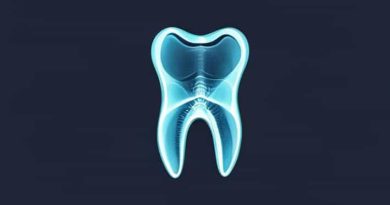 Are Dental X Rays Preventive