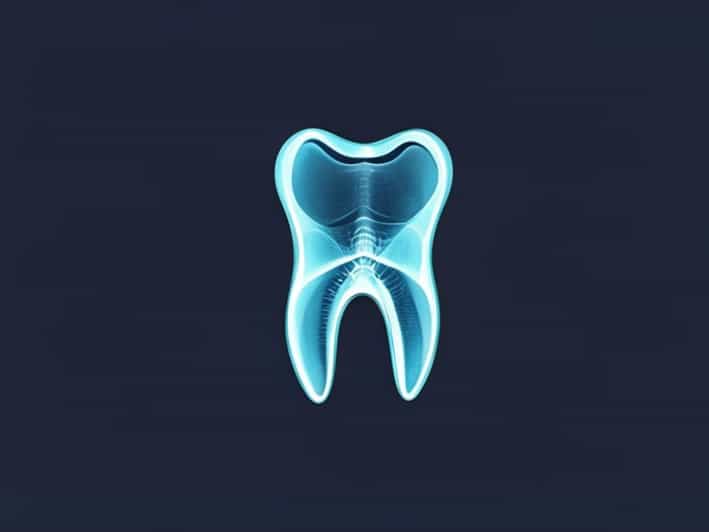 Are Dental X Rays Preventive