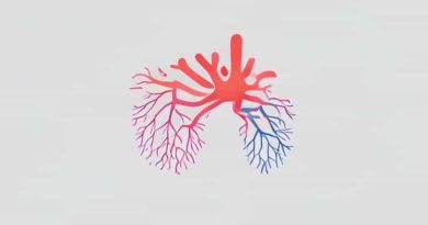 Hypersensitivity Pneumonitis Type Of Hypersensitivity