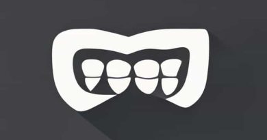 V Shaped Maxillary Arch