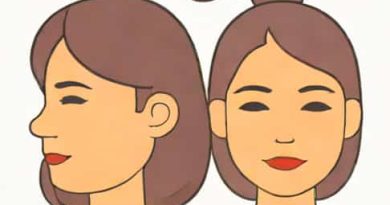 Finasteride And Women Of Childbearing Age