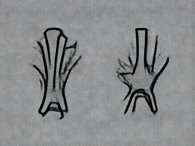 Give Two Examples Of Cartilaginous Joints