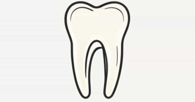 How Many Roots In Maxillary First Molar
