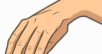 Bruised Wrist From Being Grabbed