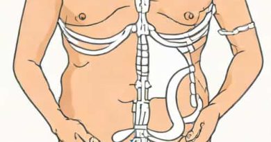 Ftm Bottom Surgery Results Healed