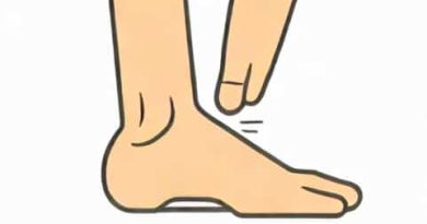 Outside Of Foot Hurts When Flexed