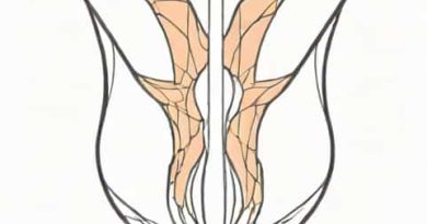 Superficial Transverse Perineal M
