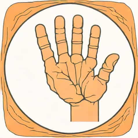 Ulnar Focal Cortical Indentation