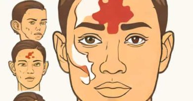 Facial Injuries Should Be Identified And Treated