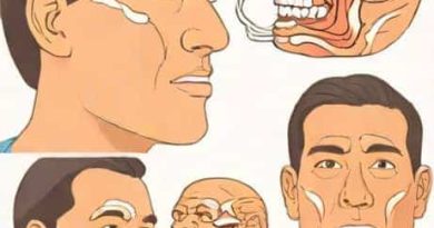 Facial Paralysis Affects Which Muscle Of Mastication