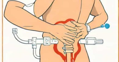 Lumbar Transforaminal Epidural Steroid Injection